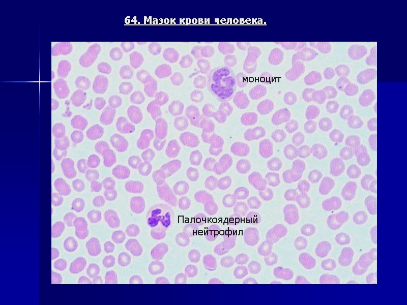 64. Мазок крови человека. моноцит Палочкоядерный нейтрофил